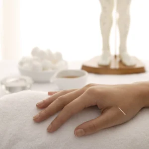 Acupuncture-01