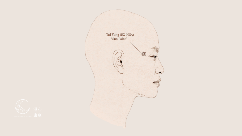 Side-profile line drawing marking the Taiyang (EX-HN5) acupressure point at the temple for tension headache and eye strain relief — Ayla Executive Medical 澄心康庭