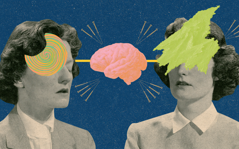 Conceptual collage comparing tension headache and migraine with acupuncture treatment approach — Ayla Executive Medical